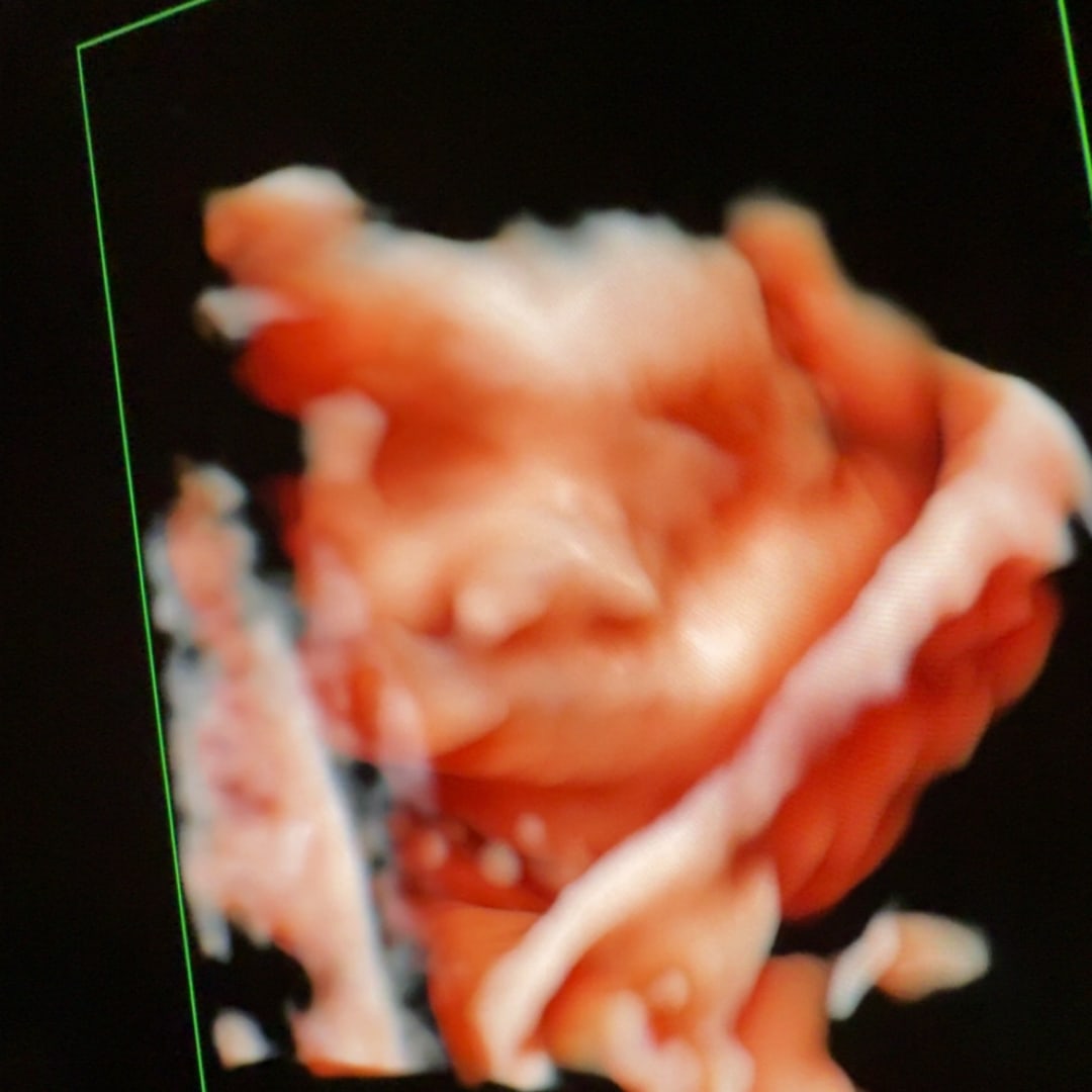 Photo shared by Hea for their Babylist baby registry.
