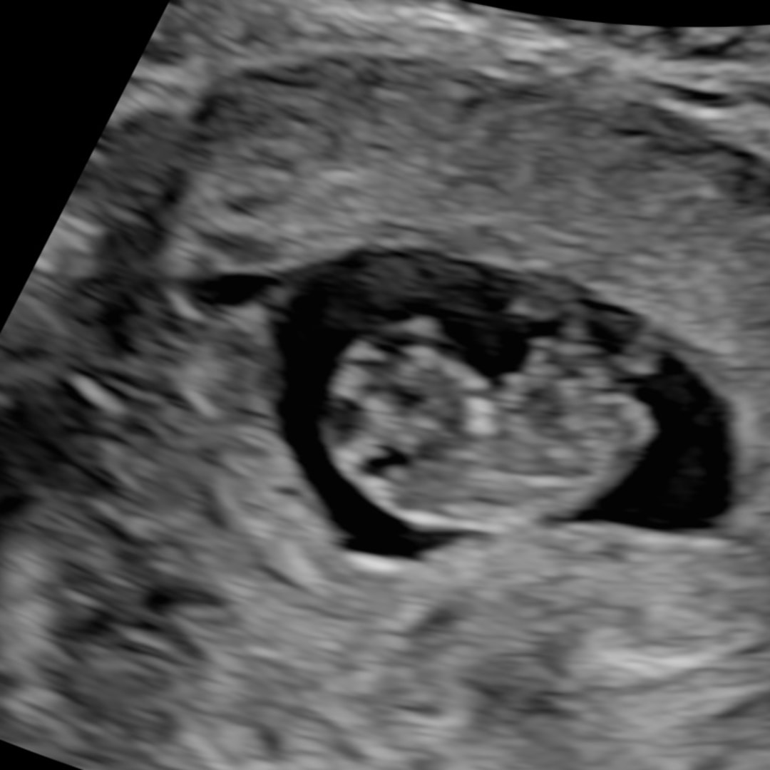 Photo shared by Diana for their Babylist baby registry.