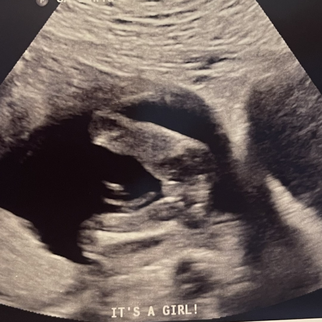Photo shared by Ariana for their Babylist baby registry.