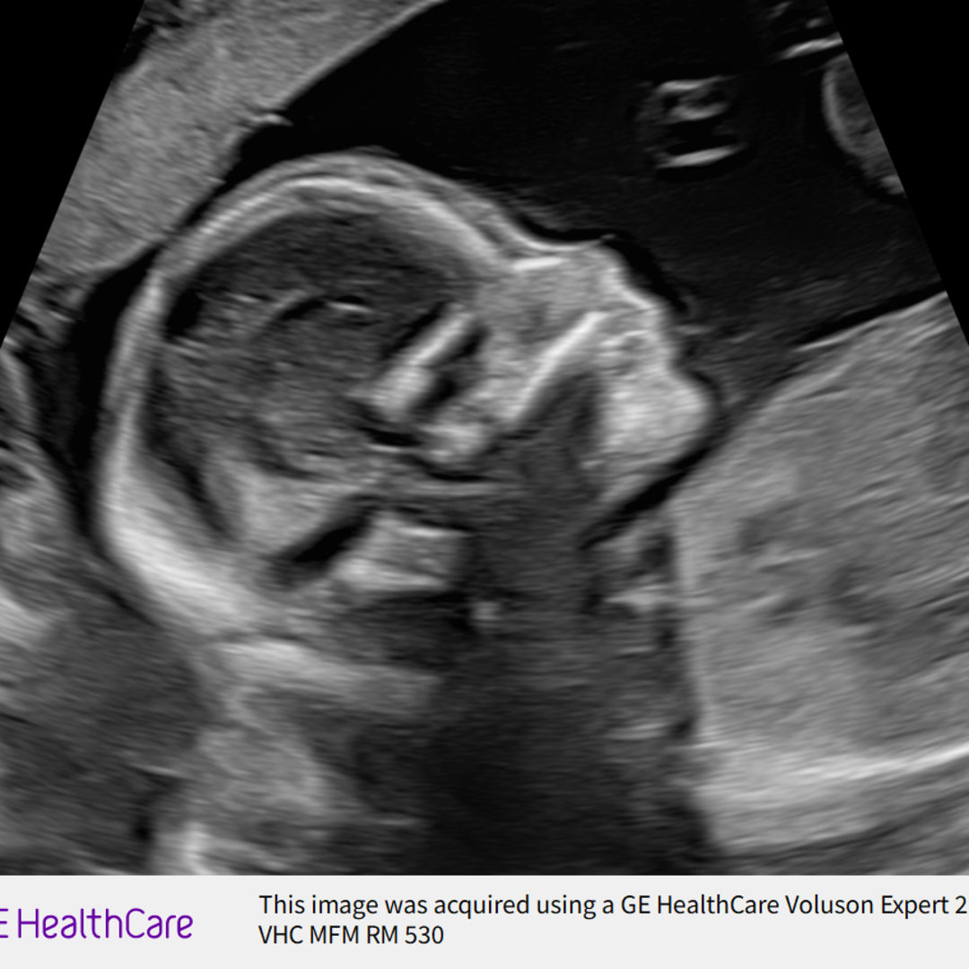 Photo shared by Kristin for their Babylist baby registry.