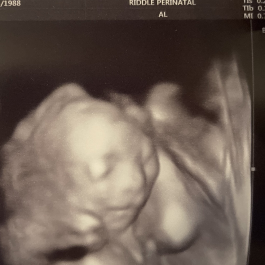 Photo shared by Sarah for their Babylist baby registry.