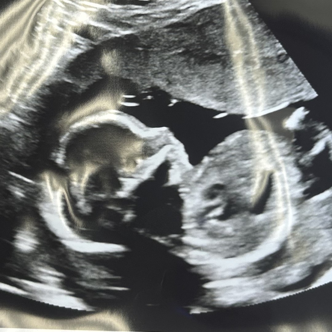 Photo shared by Jackie for their Babylist baby registry.