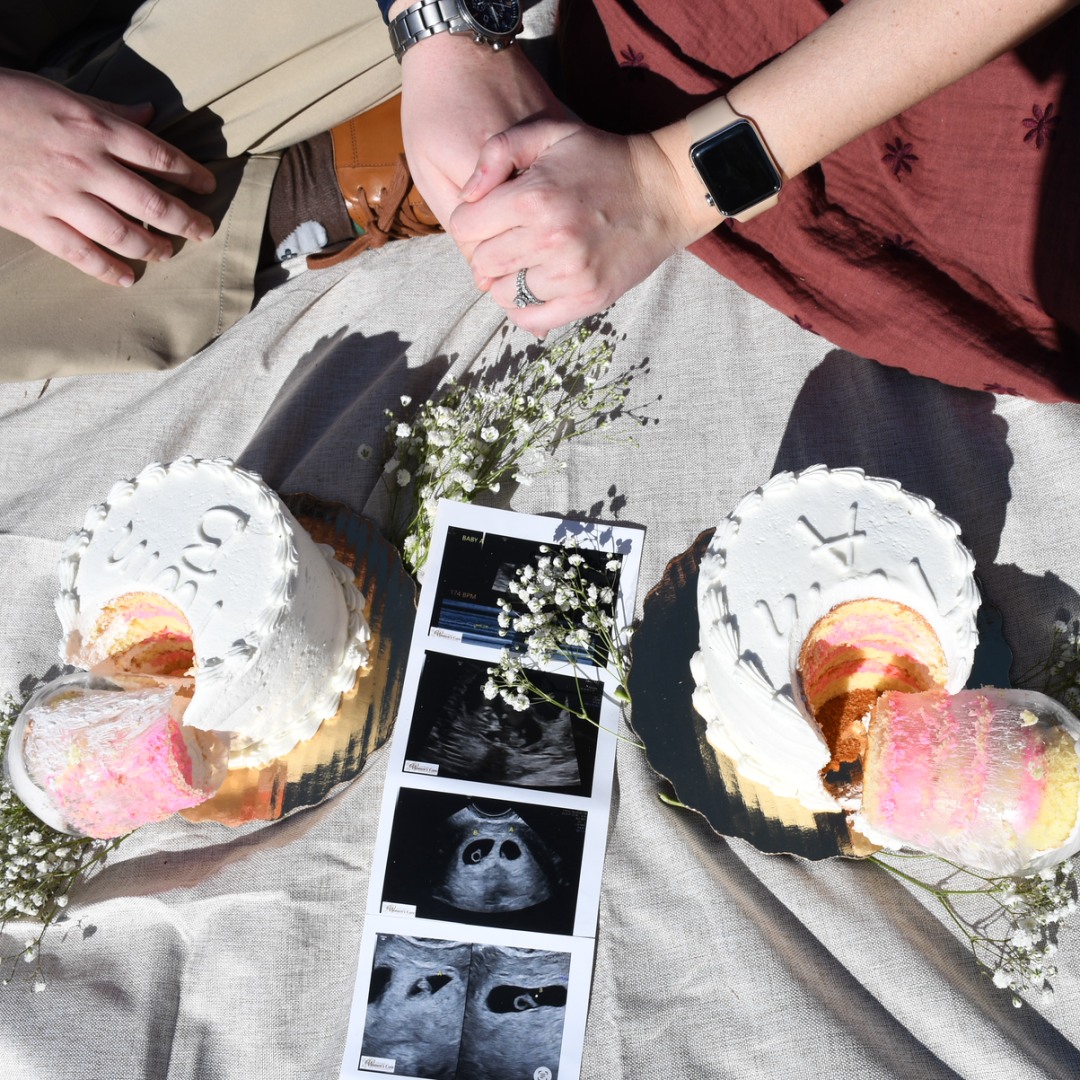 Photo shared by Madison for their Babylist baby registry.