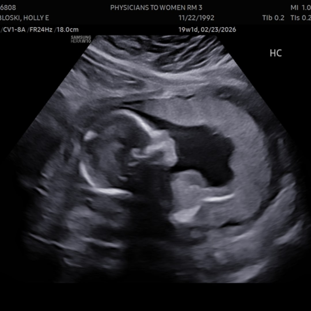 Photo shared by Holly for their Babylist baby registry.