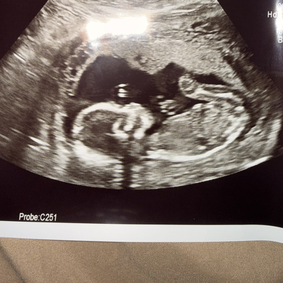 Photo shared by Kayla for their Babylist baby registry.