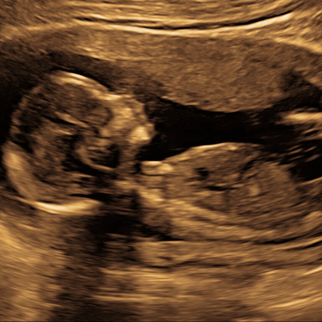 Photo shared by Rachel for their Babylist baby registry.