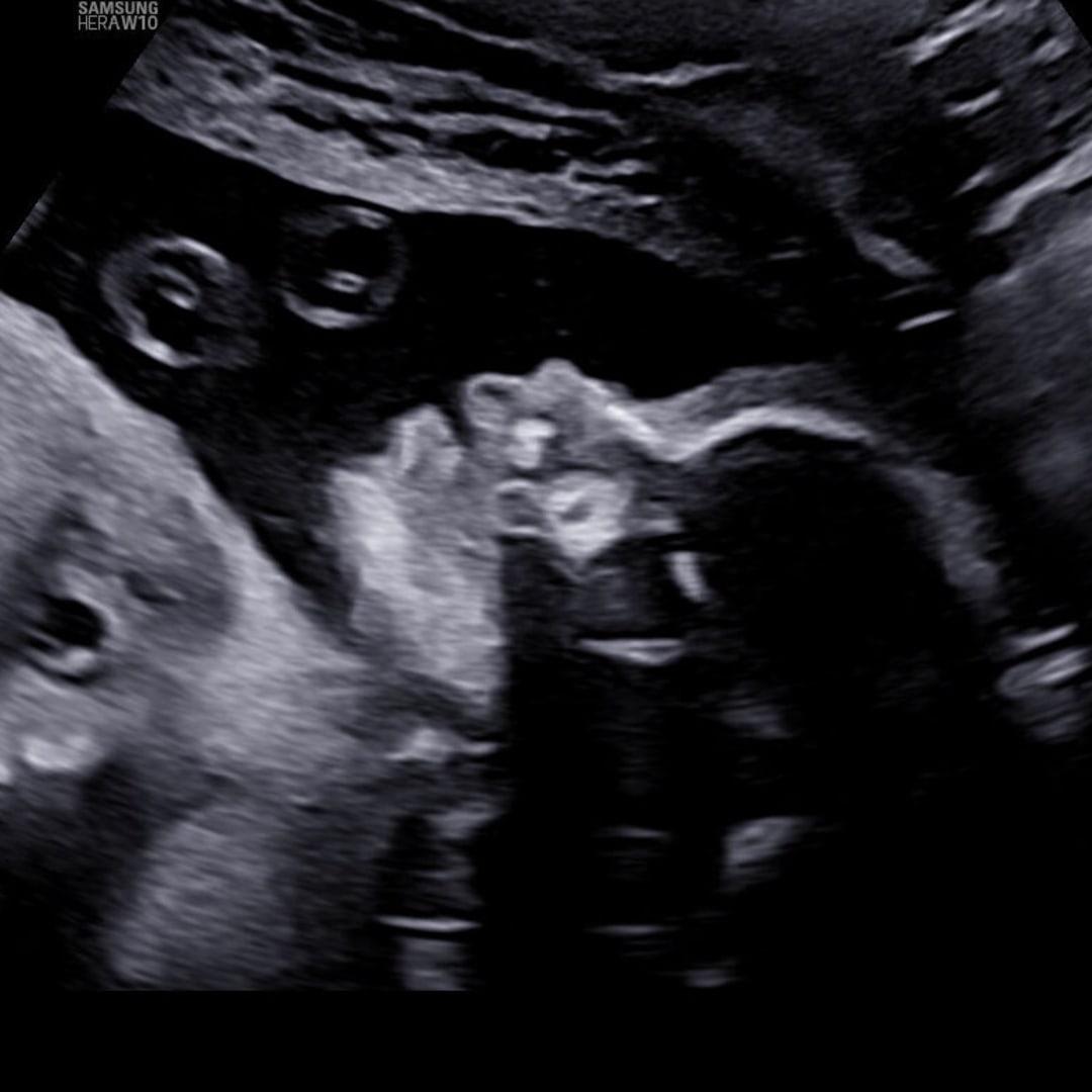 Photo shared by Breanna for their Babylist baby registry.