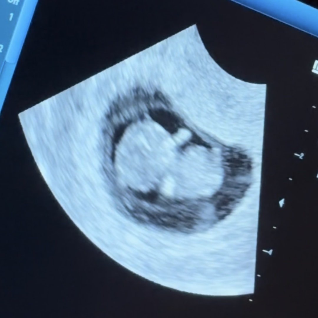 Photo shared by Marissa for their Babylist baby registry.