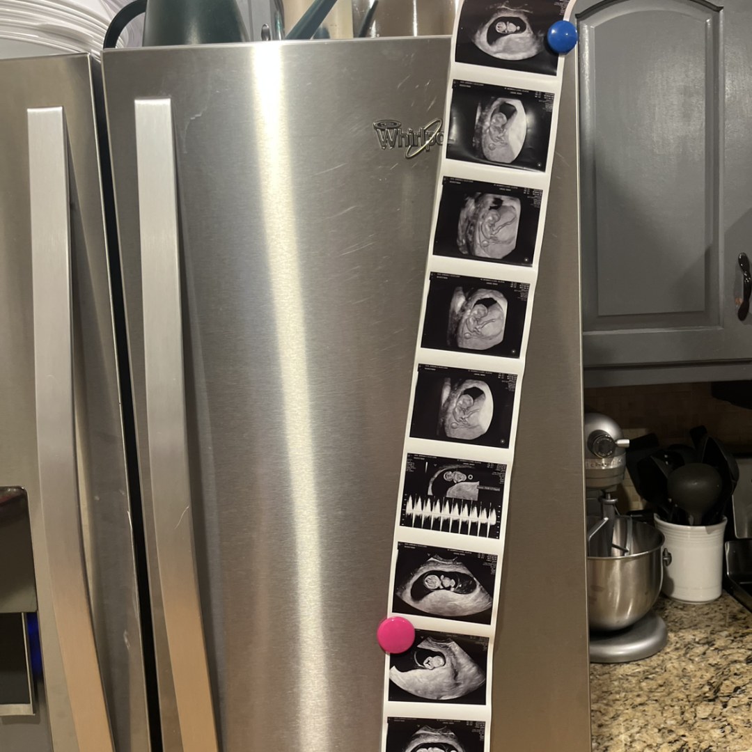 Photo shared by Jordan for their Babylist baby registry.