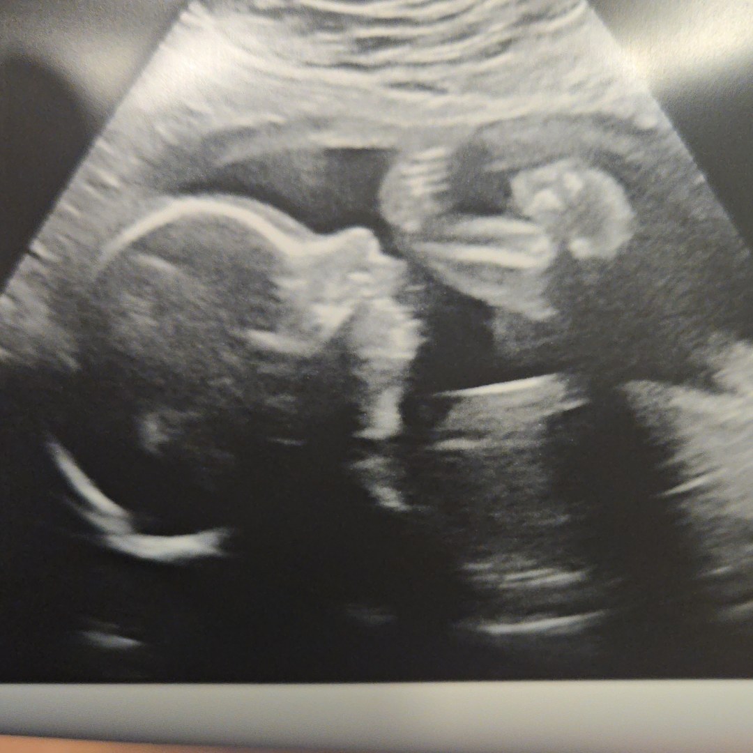 Photo shared by Hannah for their Babylist baby registry.