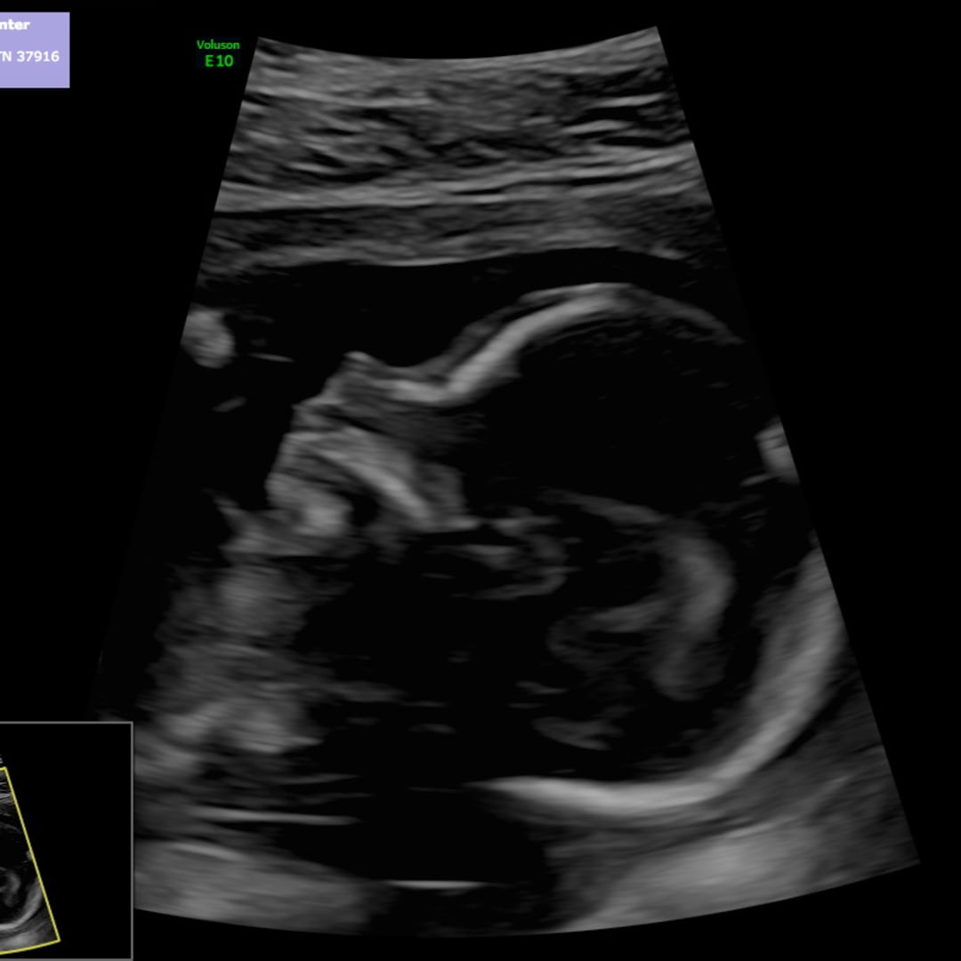 Photo shared by Annalee for their Babylist baby registry.