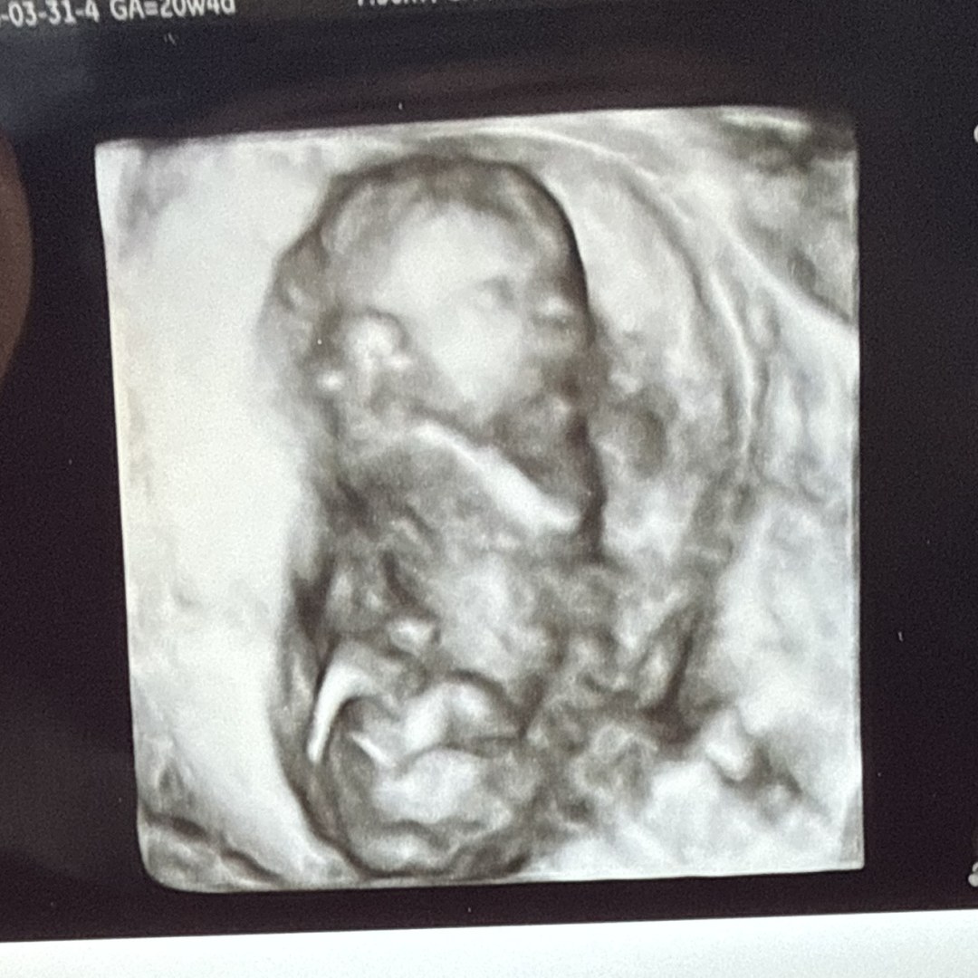 Photo shared by Chelsea for their Babylist baby registry.