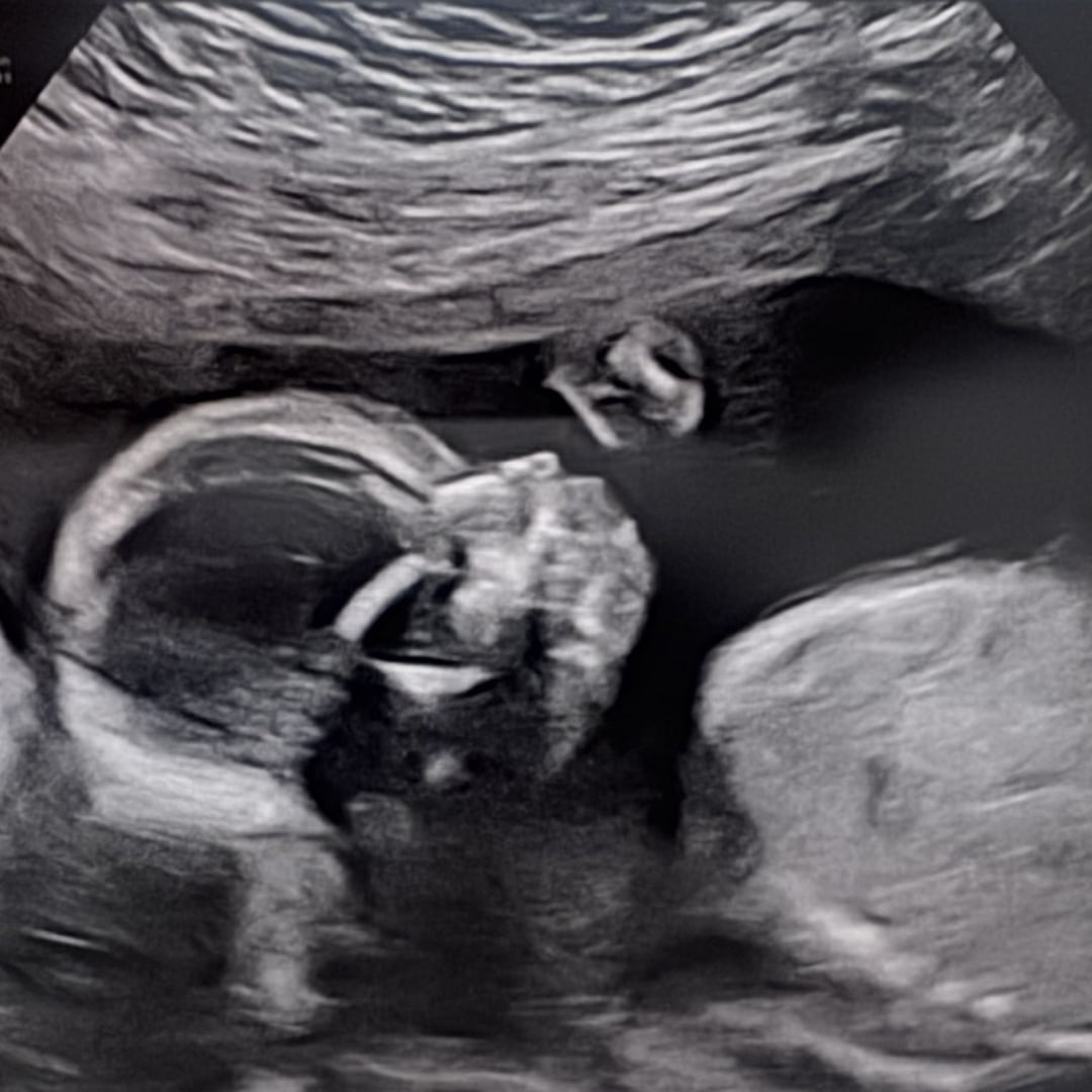 Photo shared by Emilee for their Babylist baby registry.