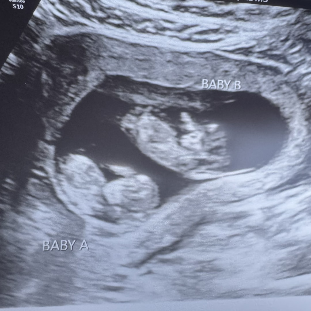 Photo shared by Renee for their Babylist baby registry.