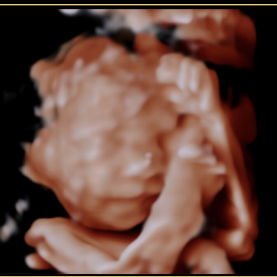 Photo shared by Alexandra for their Babylist baby registry.