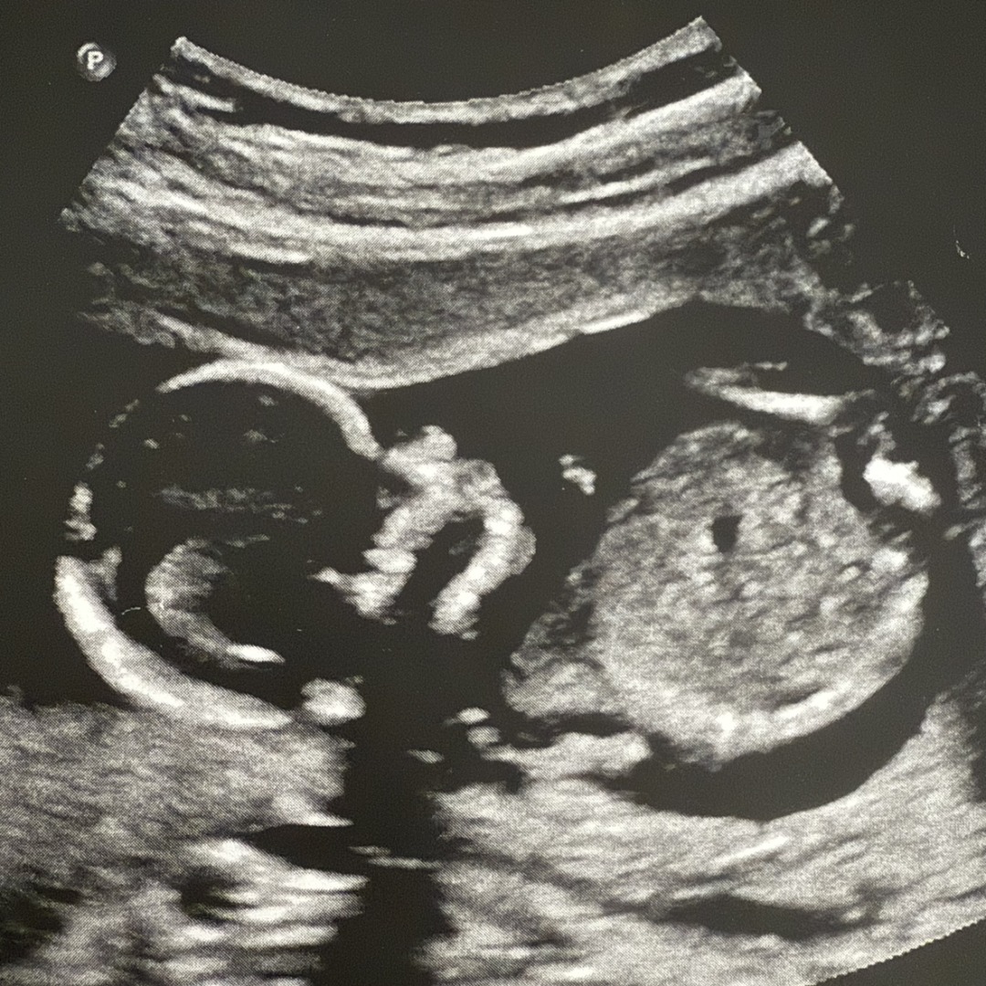 Photo shared by Keyonna for their Babylist baby registry.