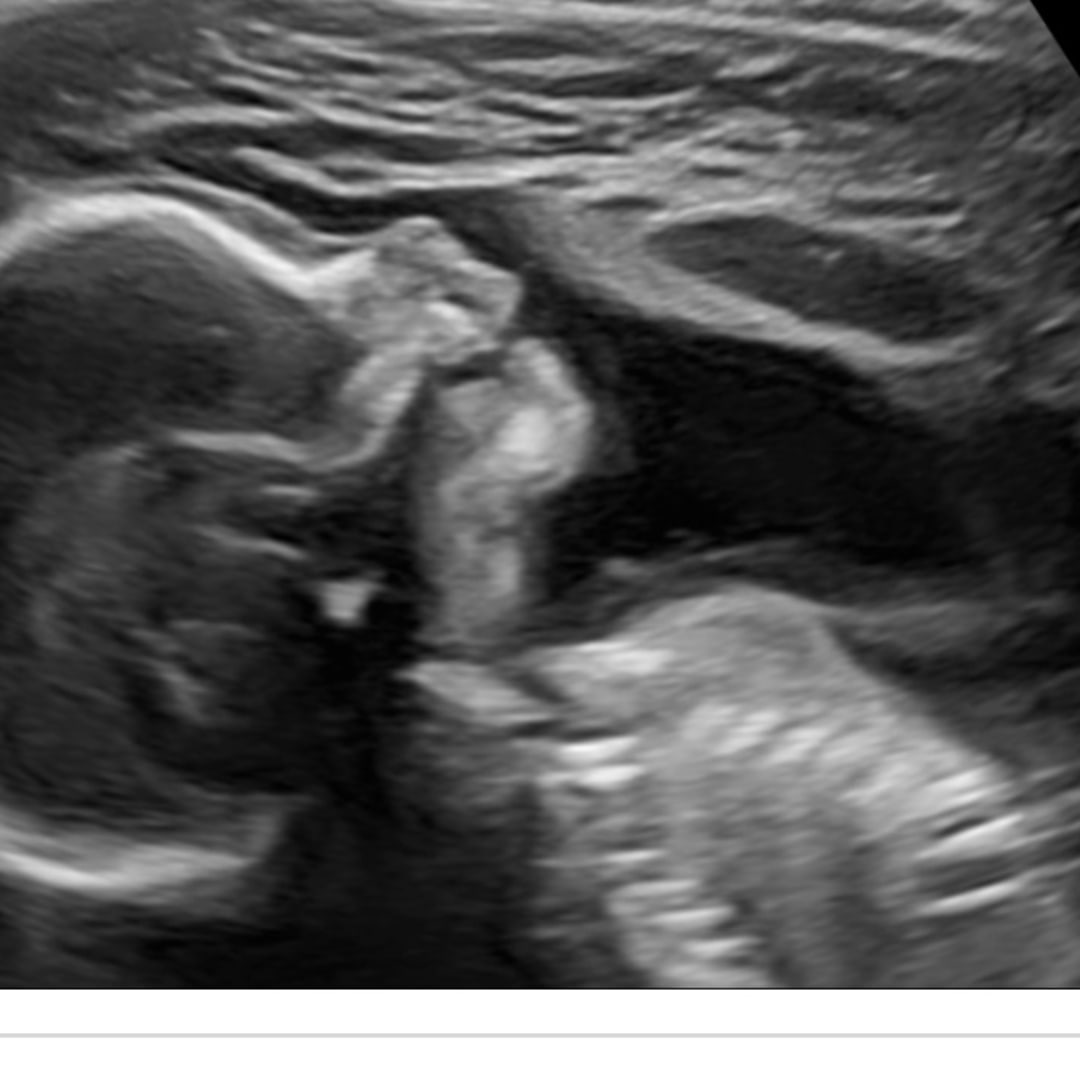 Photo shared by Casey for their Babylist baby registry.