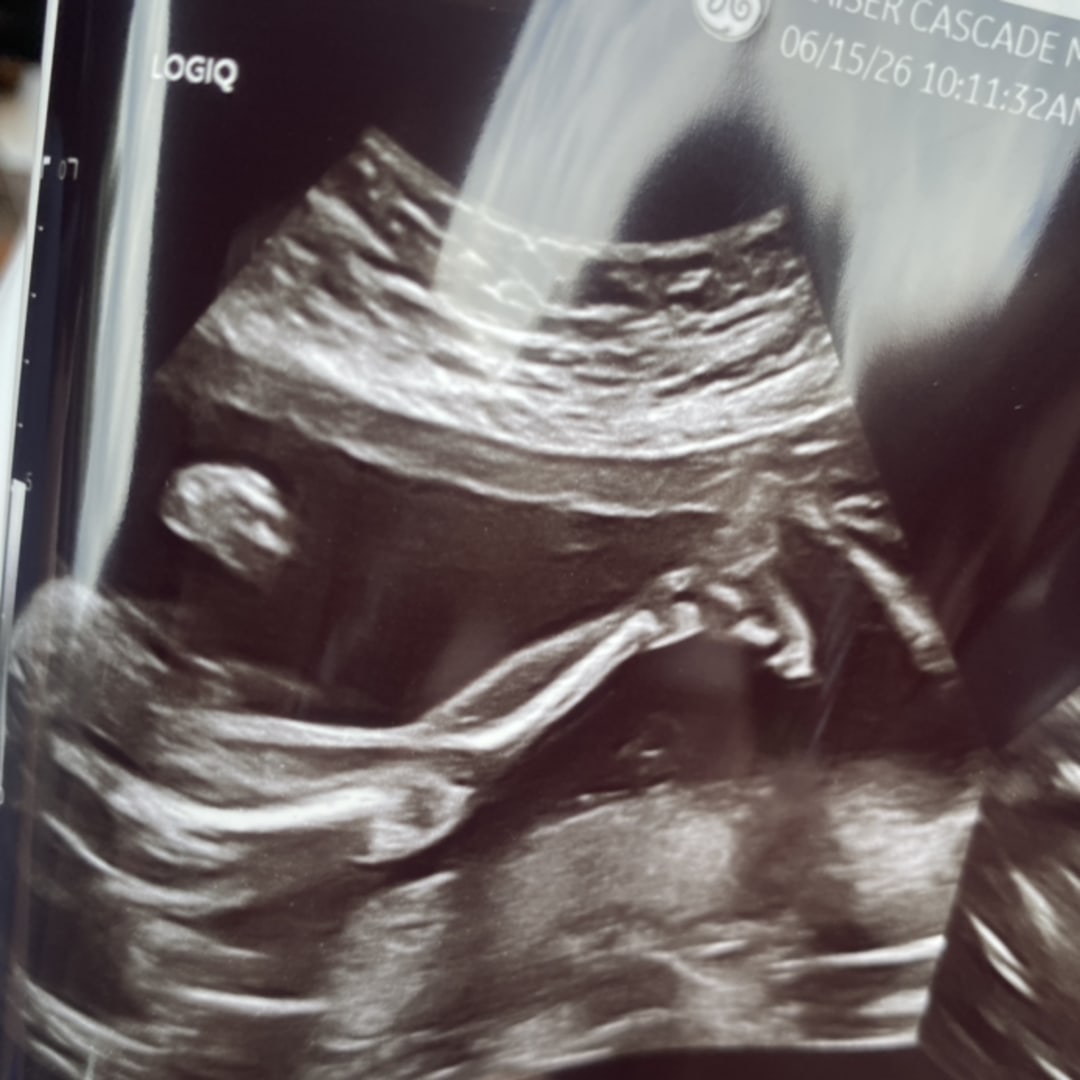 Photo shared by Tara for their Babylist baby registry.