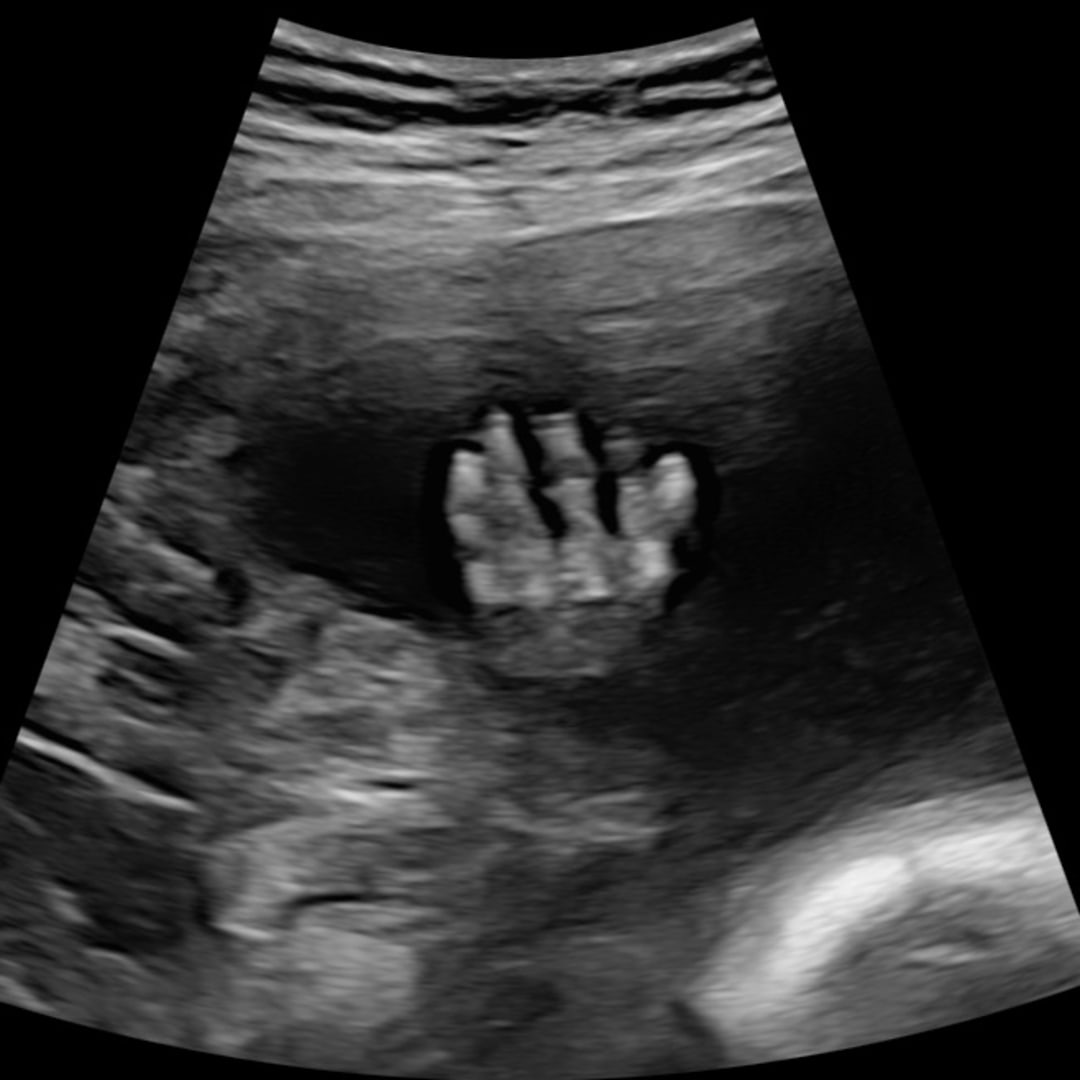 Photo shared by Kaiya for their Babylist baby registry.