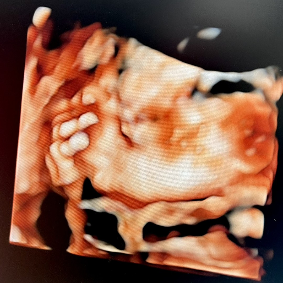 Photo shared by Kinley for their Babylist baby registry.