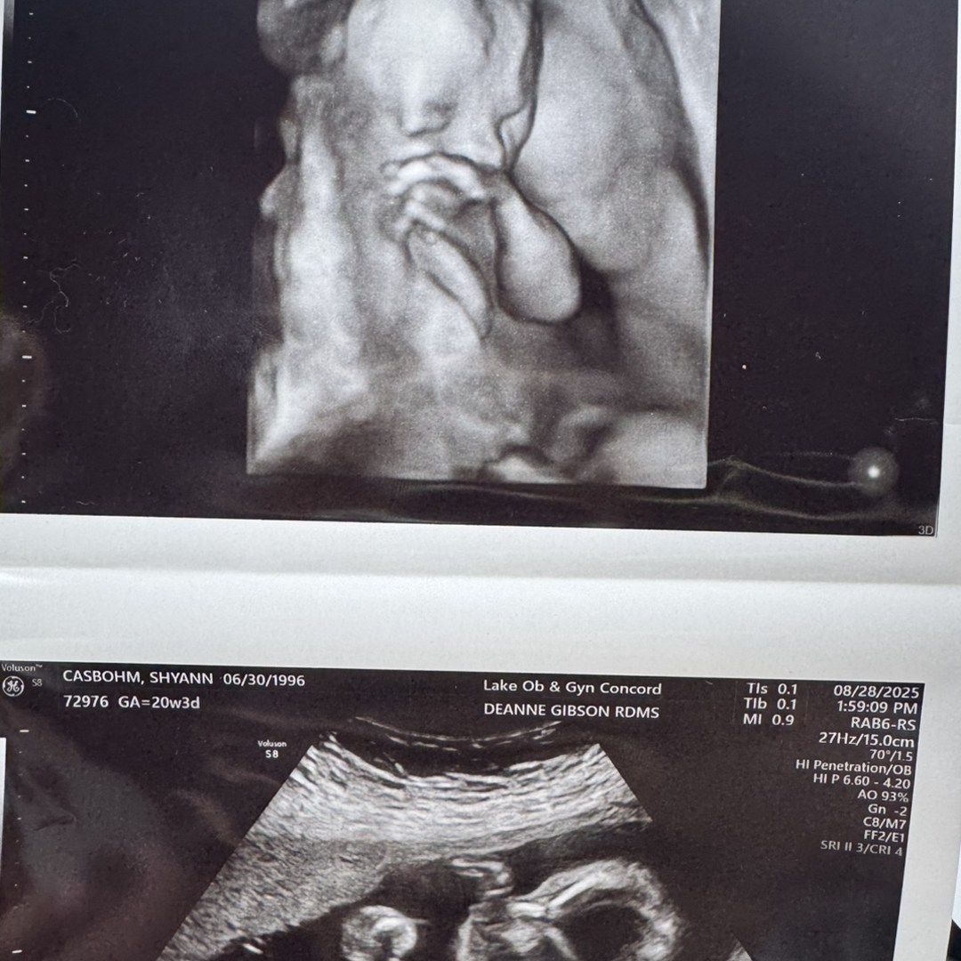 Photo shared by Shyann for their Babylist baby registry.