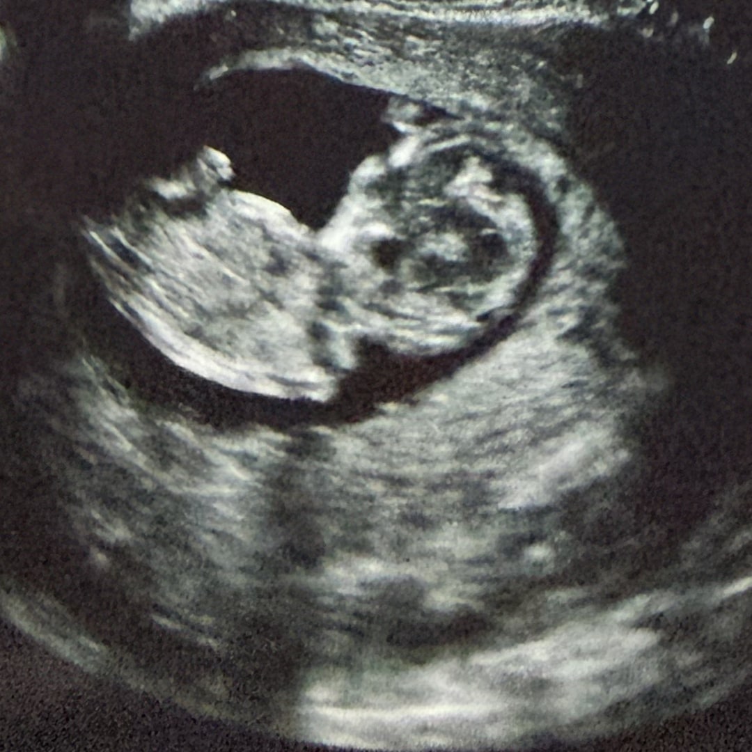 Photo shared by Nikki for their Babylist baby registry.