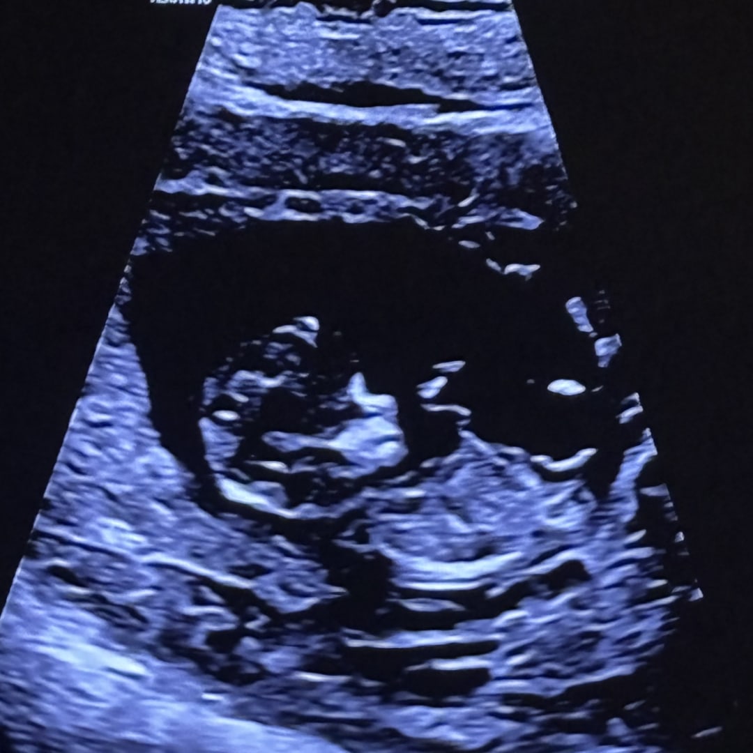 Photo shared by Ana for their Babylist baby registry.