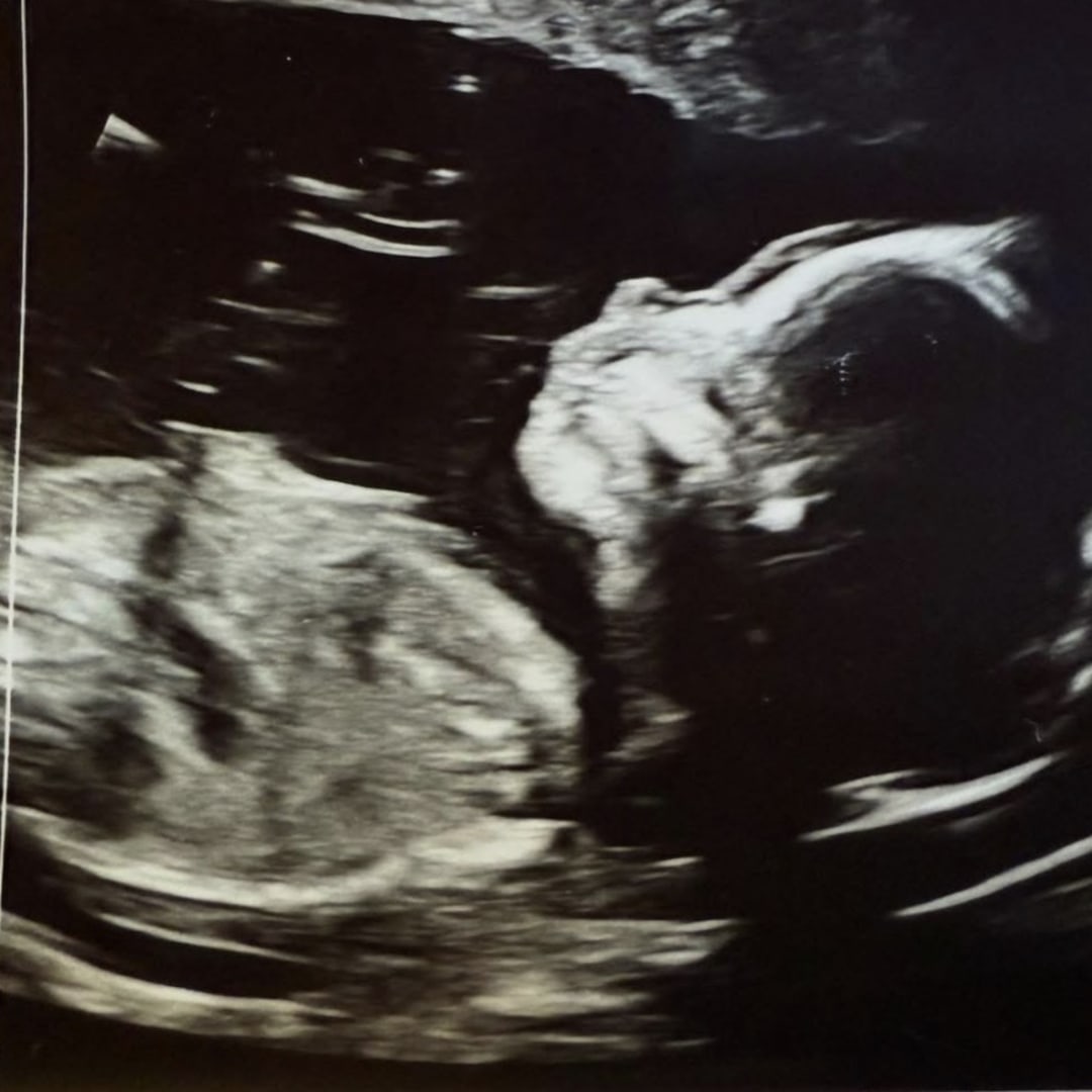 Photo shared by Karli for their Babylist baby registry.