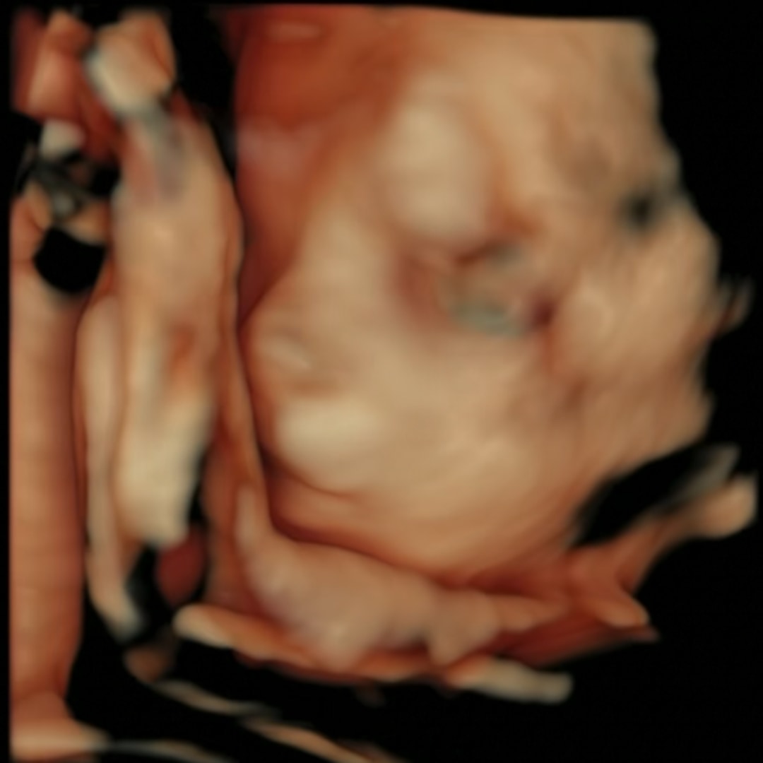 Photo shared by Alyssa for their Babylist baby registry.