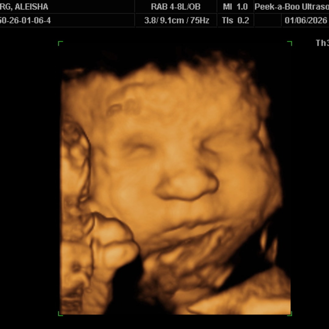 Photo shared by Aleisha for their Babylist baby registry.