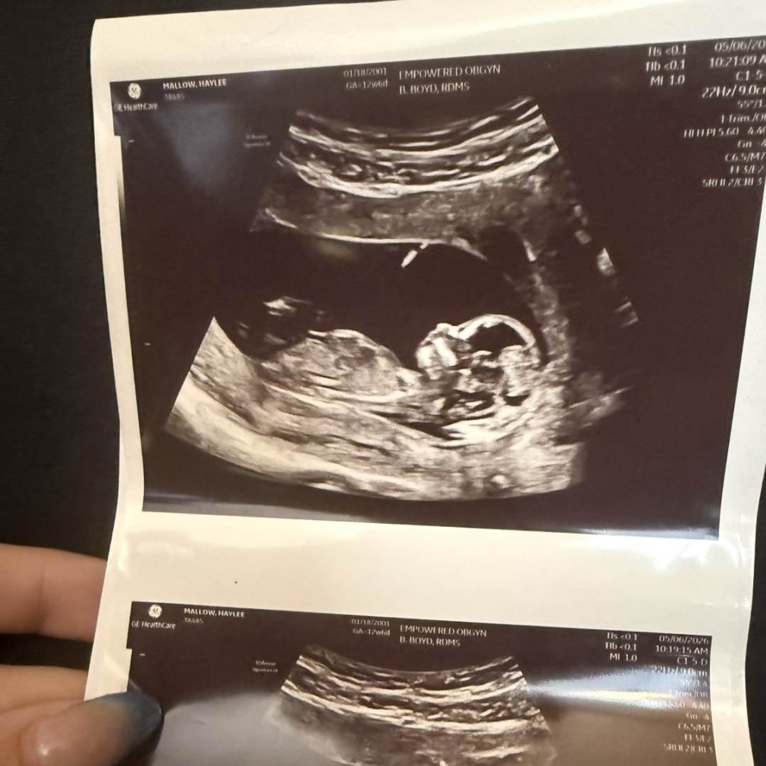 Photo shared by Haylee for their Babylist baby registry.