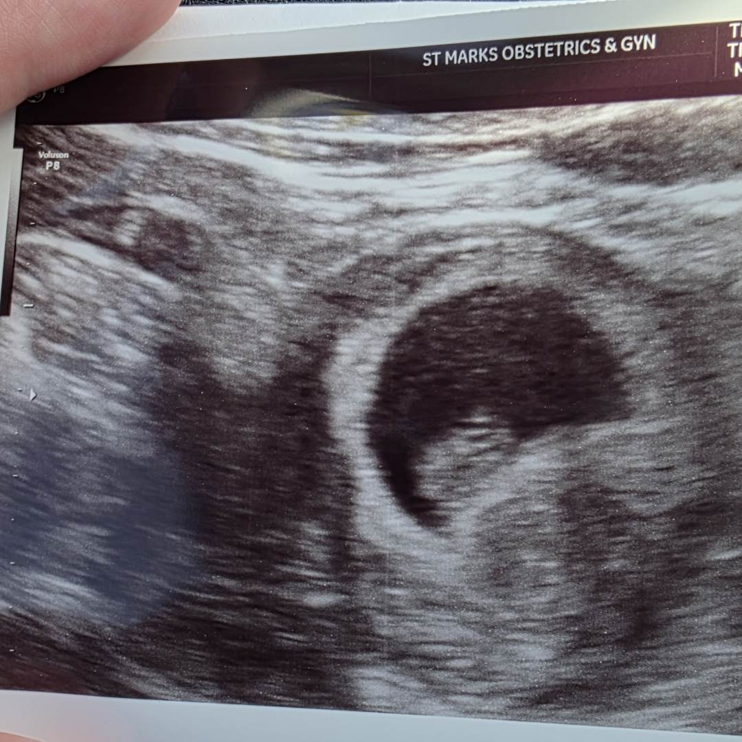 Photo shared by Amber for their Babylist baby registry.