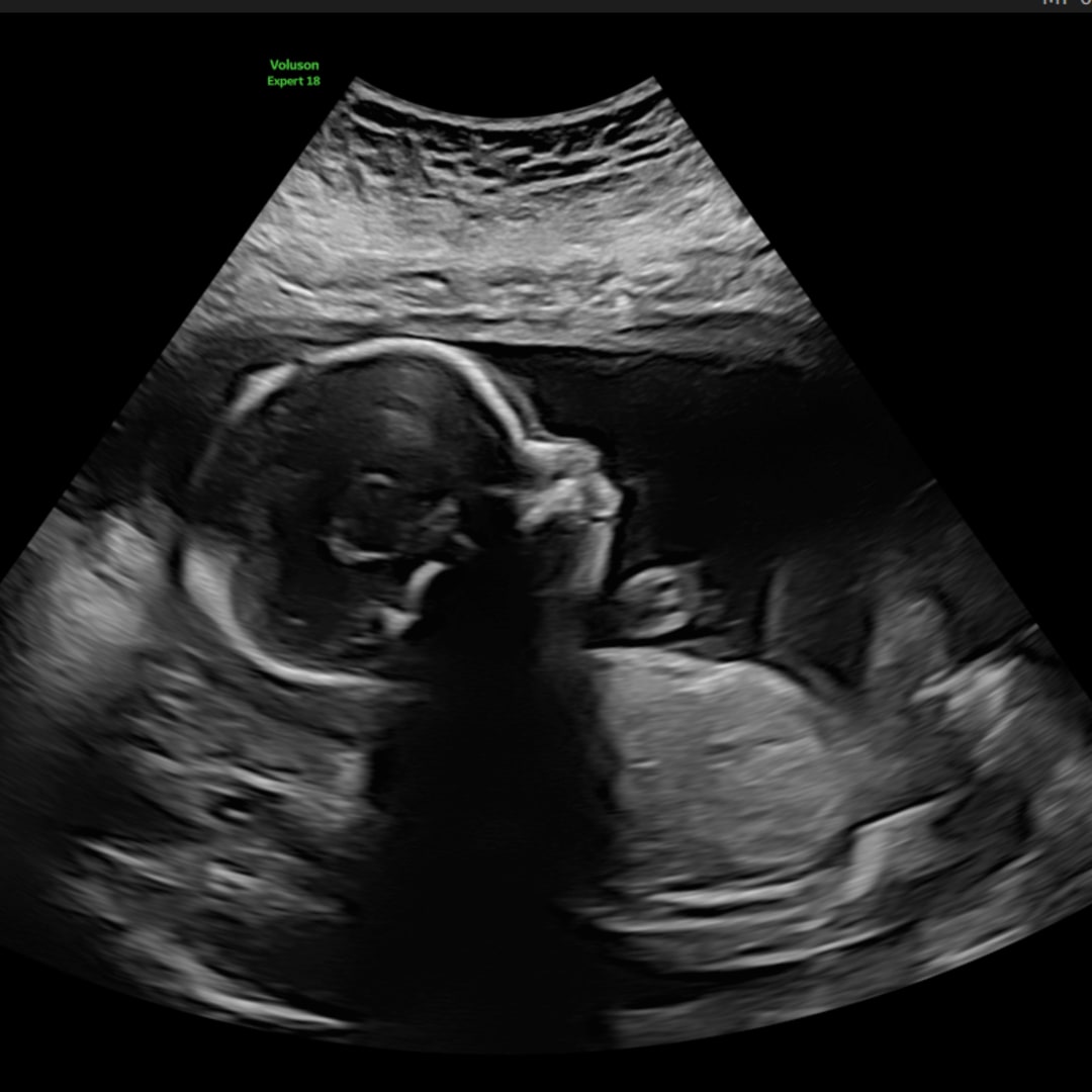 Photo shared by Rylee for their Babylist baby registry.