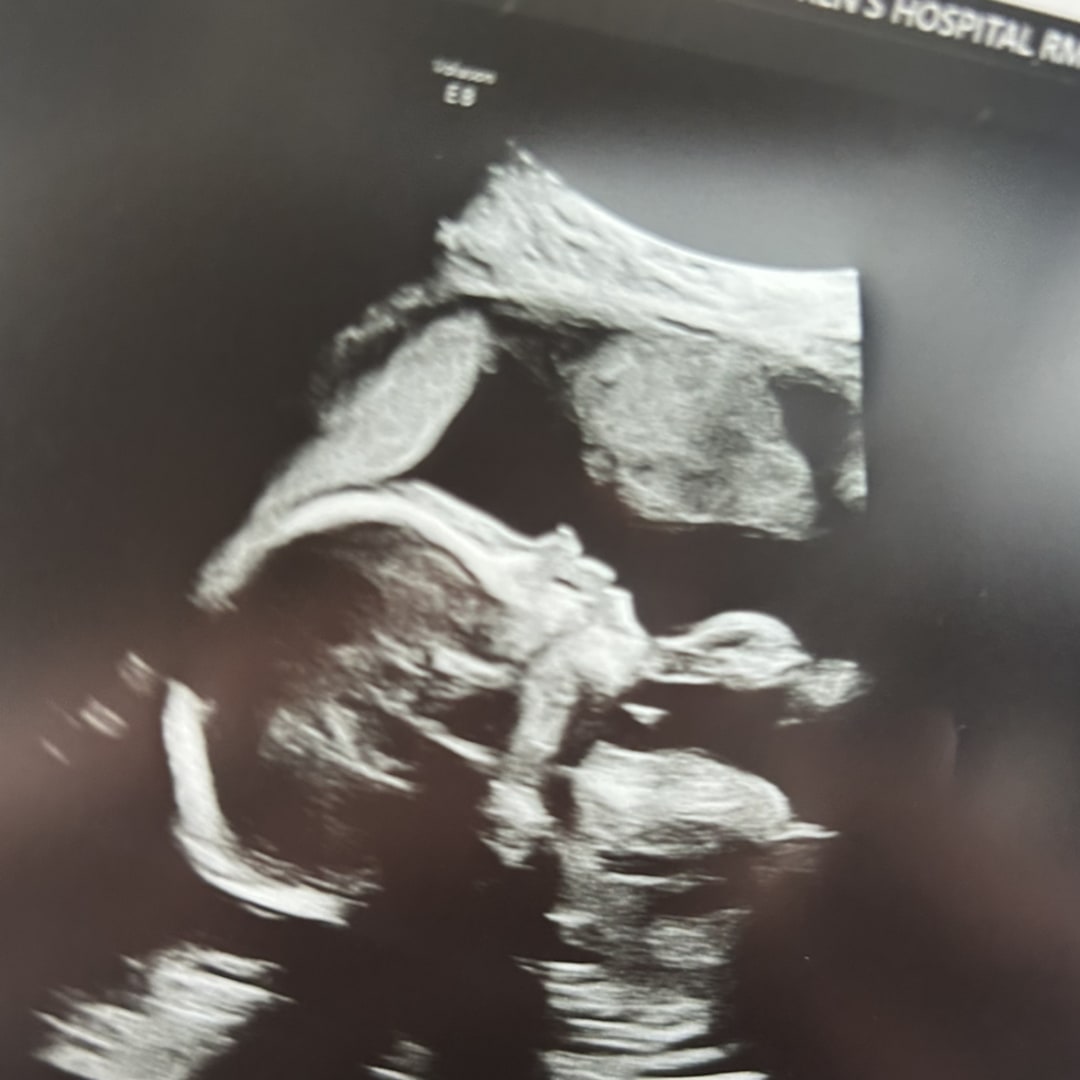 Photo shared by Hollie for their Babylist baby registry.