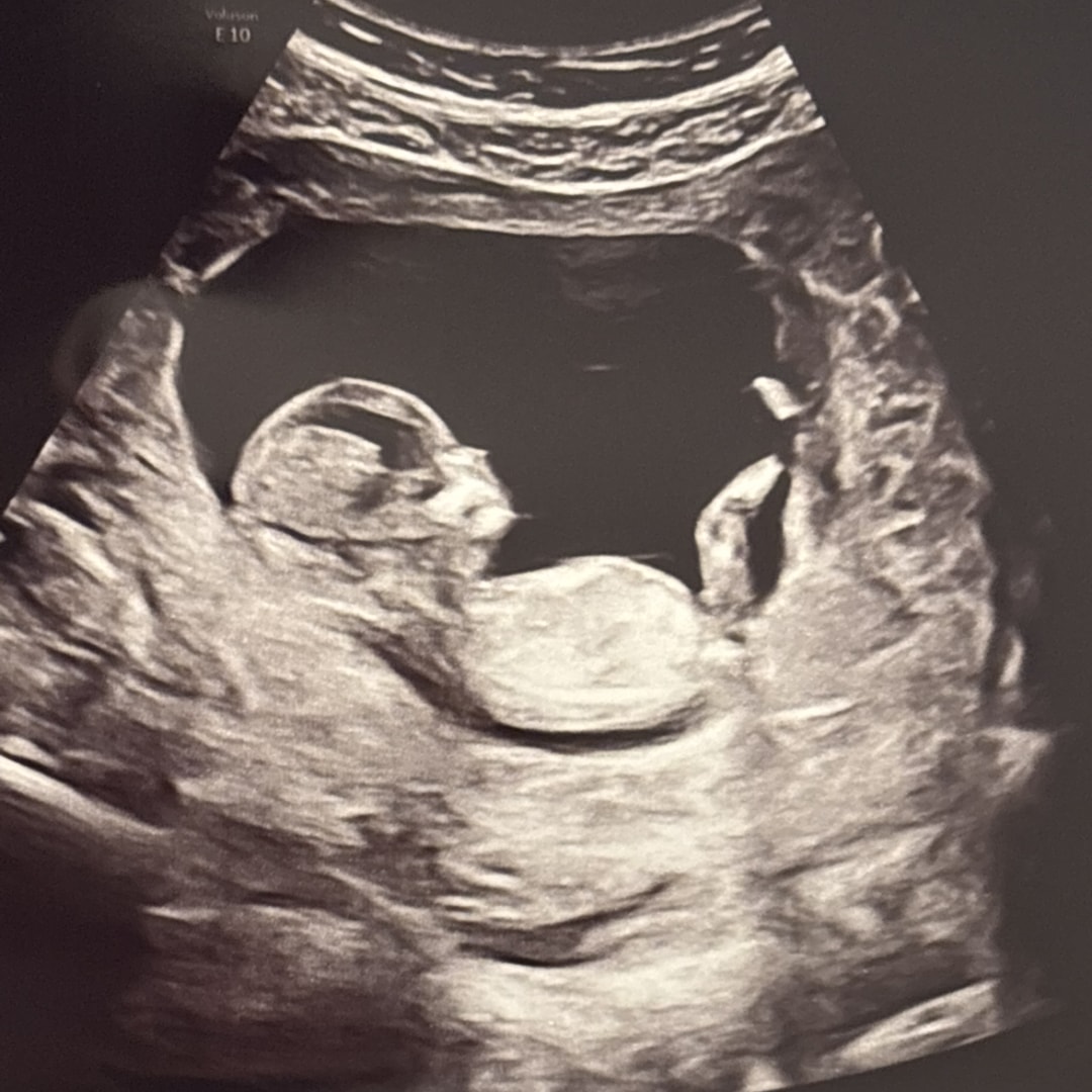 Photo shared by Maura for their Babylist baby registry.