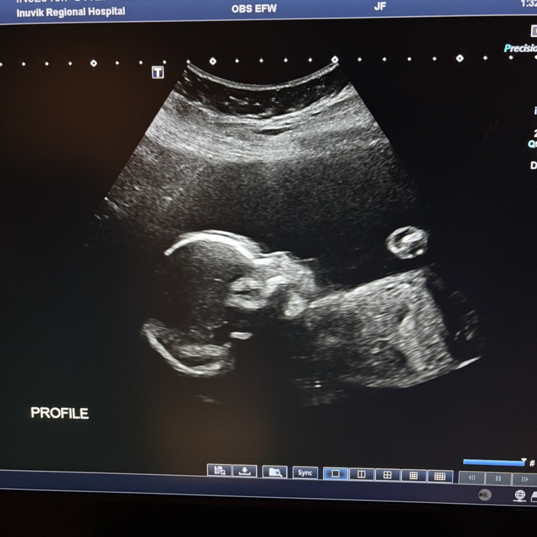 Photo shared by Ashley for their Babylist baby registry.