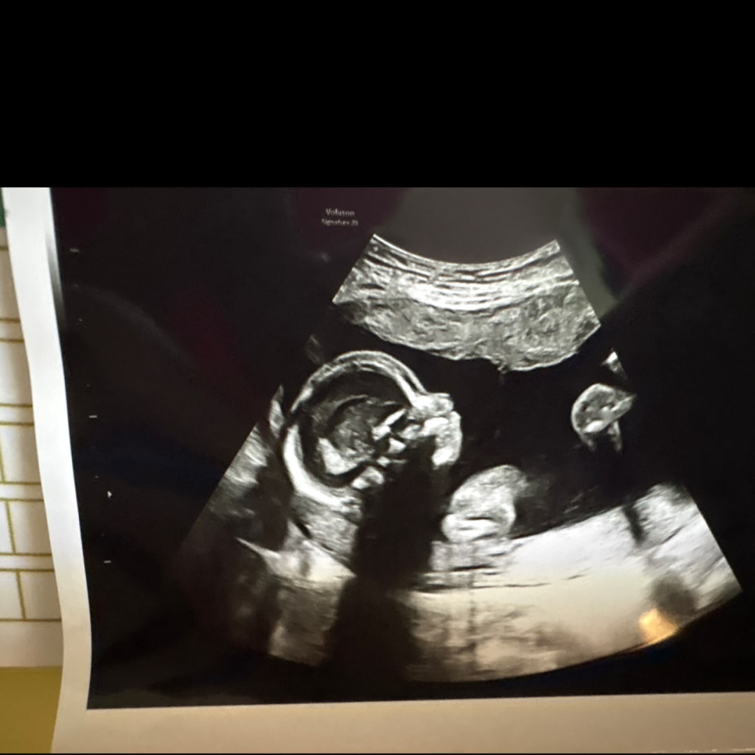Photo shared by Savannah for their Babylist baby registry.