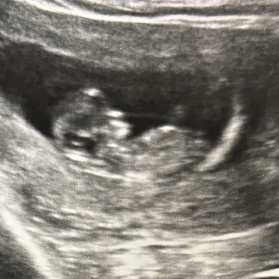 Photo shared by Britni for their Babylist baby registry.