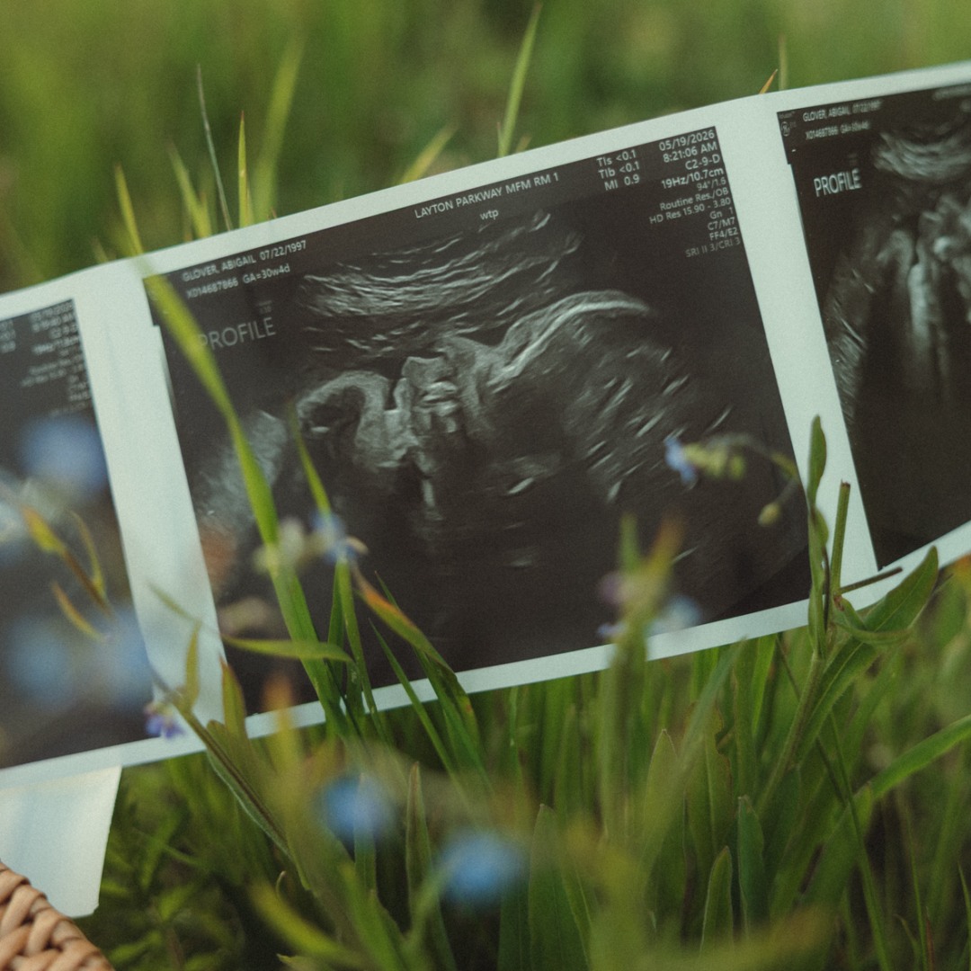 Photo shared by Abbie for their Babylist baby registry.
