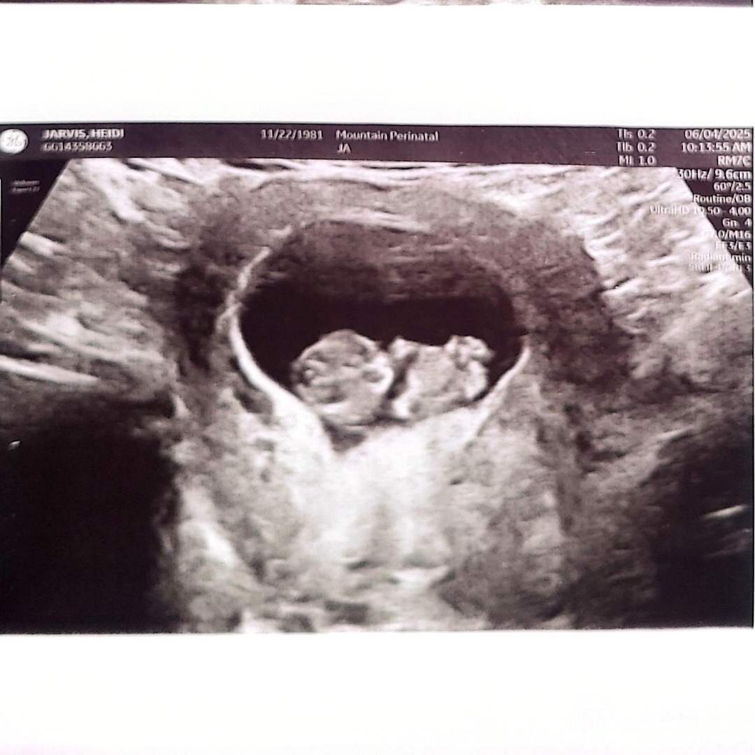 Photo shared by Heidi for their Babylist baby registry.