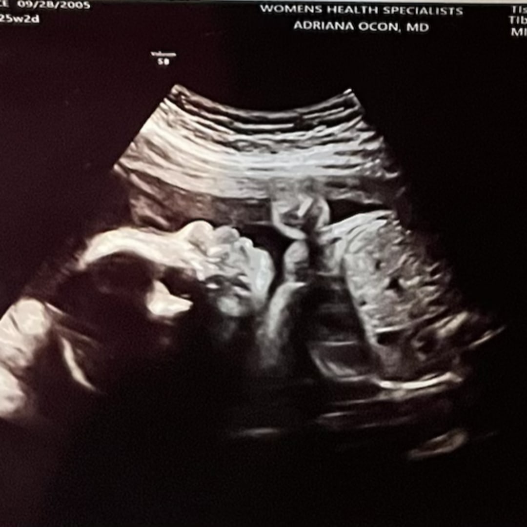 Photo shared by Dulce for their Babylist baby registry.