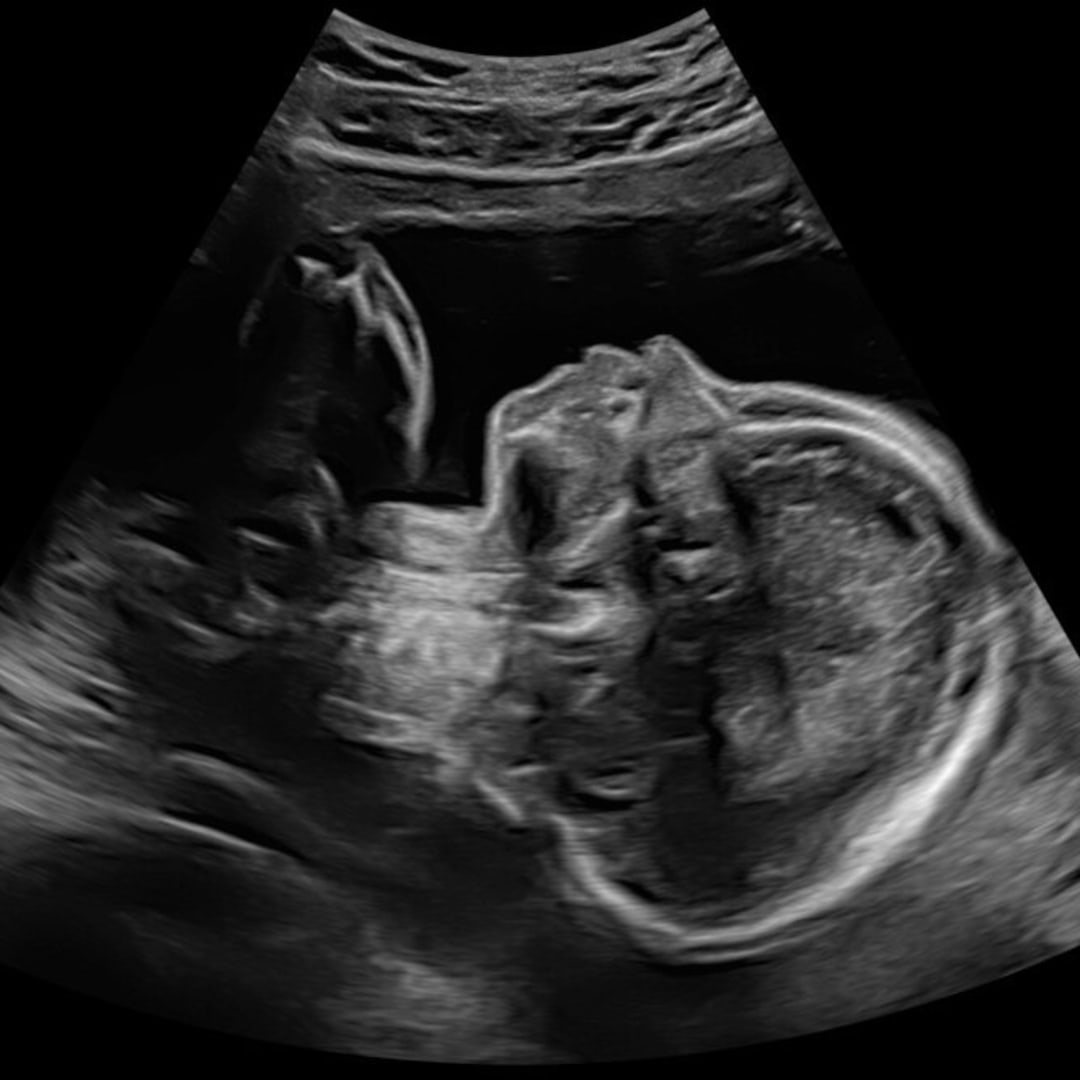 Photo shared by Adrienne for their Babylist baby registry.