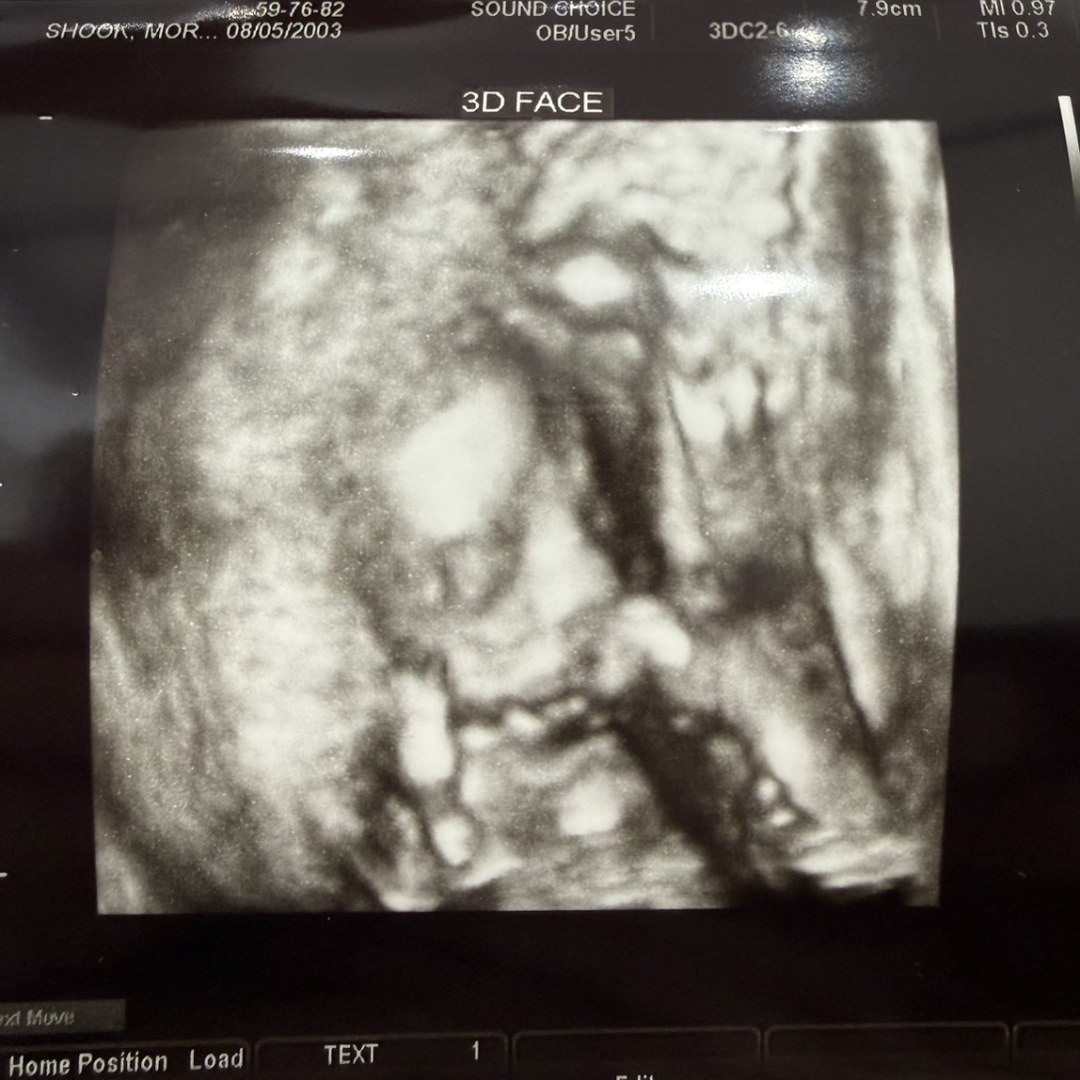 Photo shared by Morgan for their Babylist baby registry.