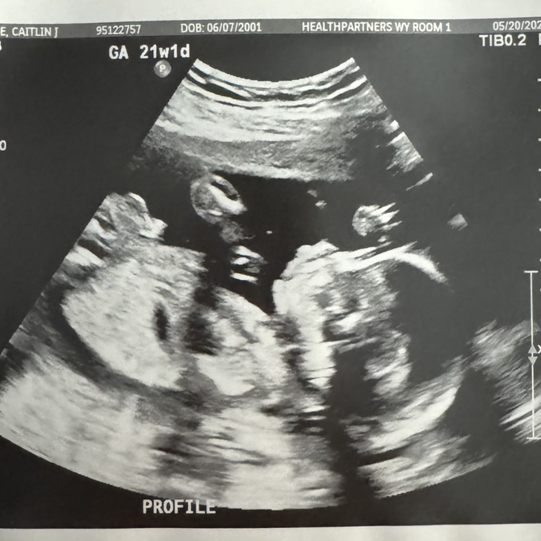 Photo shared by Caitlin for their Babylist baby registry.