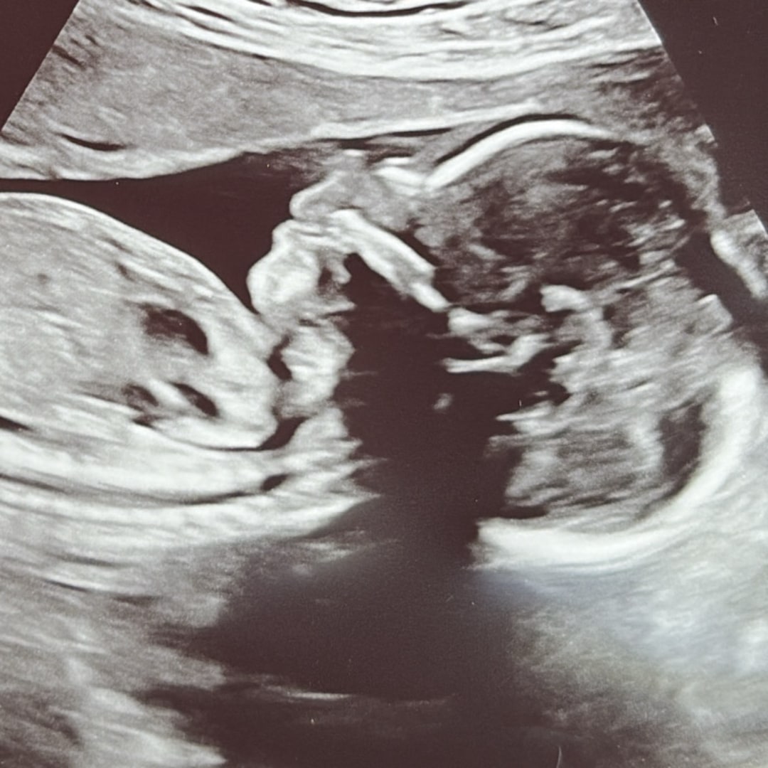 Photo shared by Eva for their Babylist baby registry.