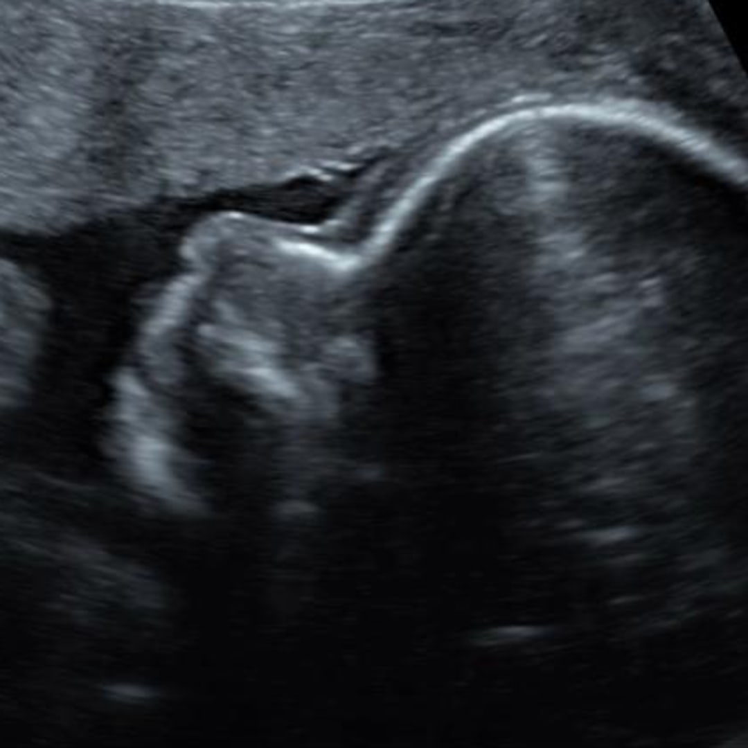 Photo shared by Aliah for their Babylist baby registry.