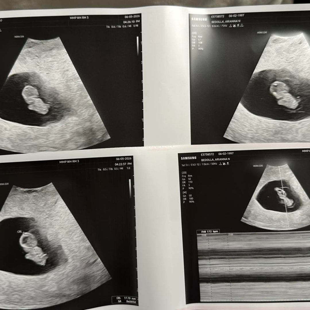 Photo shared by Arianna for their Babylist baby registry.