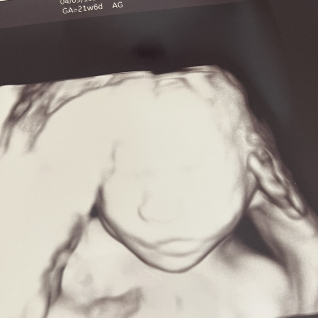 Photo shared by Brittany for their Babylist baby registry.