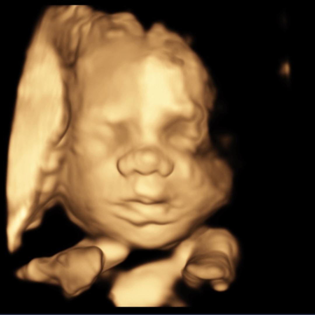 Photo shared by Cassie for their Babylist baby registry.