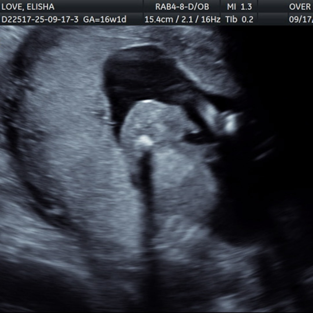 Photo shared by Elisha for their Babylist baby registry.